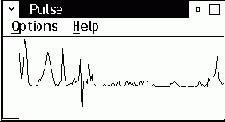 Pulse
